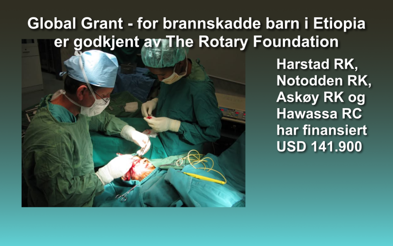 Nytt GLOBAL GRANT prosjekt i Harstad Rotaryklubb